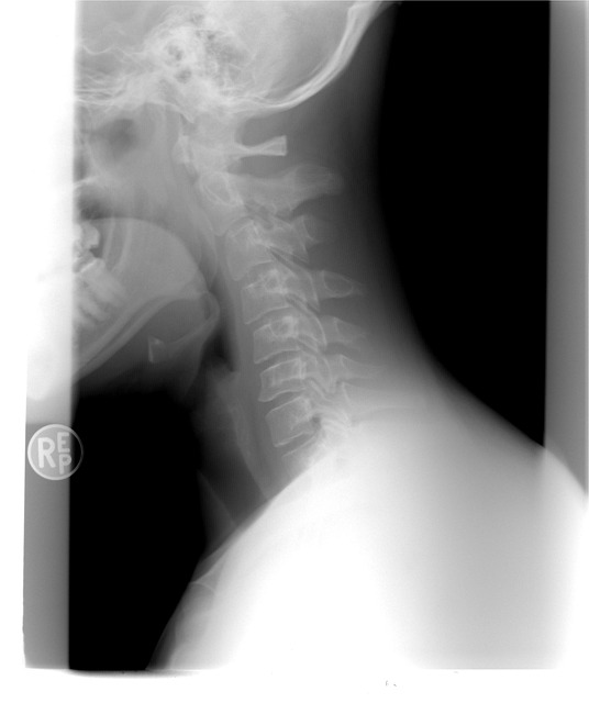 Trusted Chiropractor Care for Kids: Superior Spinal Health Solutions