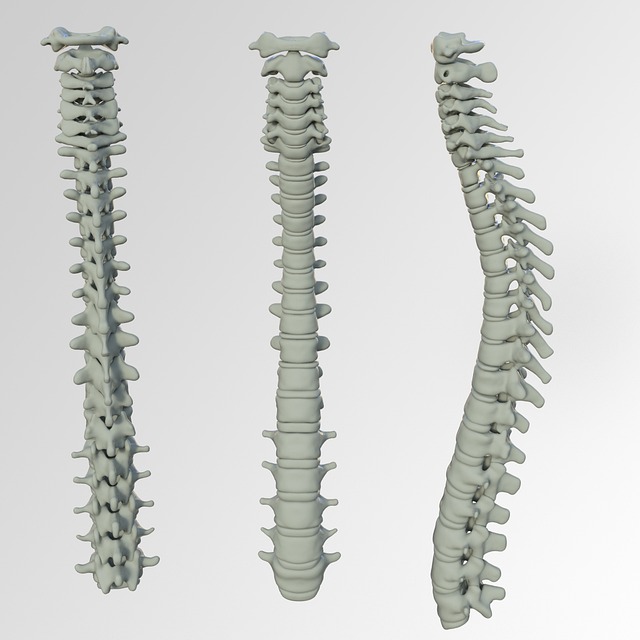 Proven Natural Remedies for Effective Sciatica & Neck Pain Relief