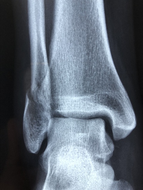 sports-injury-chiropractic-frisco-640x480-70200866.jpeg