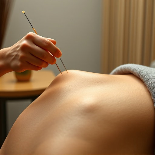 acupuncture-for-pain-relief-640x480-40806525.jpeg