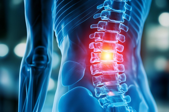 herniated-disc-therapy-640x480-54639606.jpeg