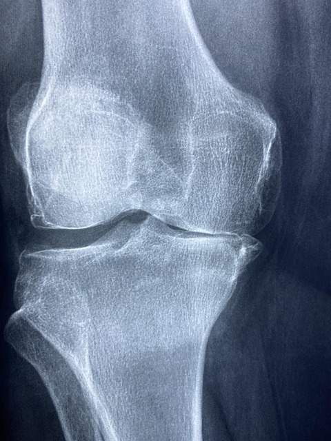 Trusted Chiropractic Care for Superior Sports Injury Recovery in Frisco
