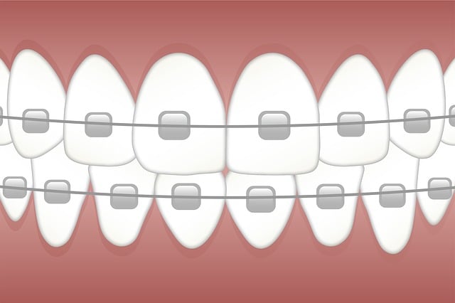 spinal-alignment-640x480-9777698.jpeg