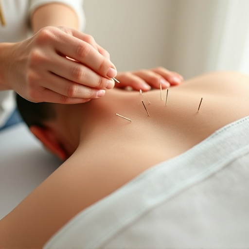 acupuncture-for-pain-relief-640x480-14761755.jpeg