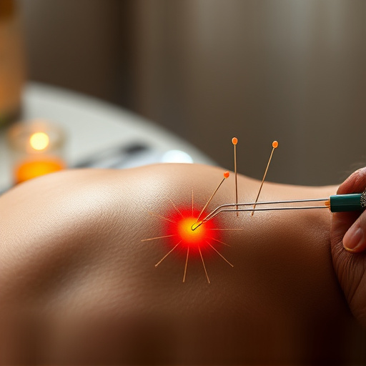 acupuncture-for-pain-relief-640x480-58690836.jpeg