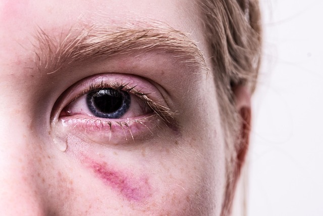 sports-injury-recovery-640x480-99972001.jpeg