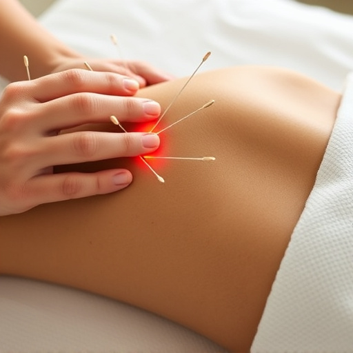 acupuncture-for-pain-relief-640x480-88640516.jpeg