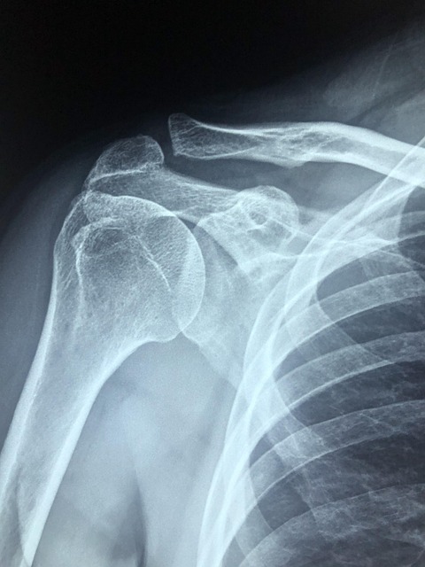 non-invasive-pain-treatment-frisco-640x480-62643028.jpeg