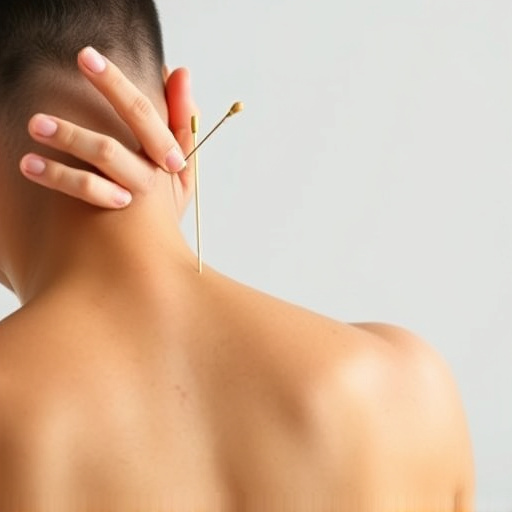 acupuncture-for-pain-relief-640x480-38976581.jpeg